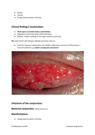 ● Itching.
● Tearing.
● Foreign body sensation in the eye,
Clinical findings/ examination:
● White spots around the limbus called follicles​​.
● Vegetations around the limbus lead to blindness.
● Papillae –nodular swellings on the upper tarsal of conjunctiva.
RX:​​ avoid contact with allergens (ideally) preventive measure.
● Treat the reactions/ inflammation with NSAIDS, SAIDS only at the time of inflammation +
mast cell stabilizers e.g​. sodium cromglycate and patanol​​.
Infections of the conjunctiva:
Bacterial conjunctiva​​: mainly caused +ve.
Manifestations:
● Foreign body sensation in the eye.
Dr Ndayisaba corneille Computer programmer
 