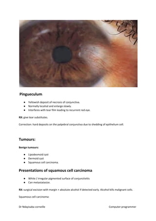 ​Pingueculum​​:
● Yellowish deposit of necrosis of conjunctiva.
● Normally localisd and enlarge slowly.
● Interferes with tear film leading to recurrent red eye.
RX:​​ give tear substitutes.
Correction: hard deposits on the palpebral conjunctiva due to shedding of epithelium cell.
Tumours:
Benign tumours:
● Lipodesmoid cyst
● Dermoid cyst
● Squamous cell carcinoma.
Presentations of squamous cell carcinoma​​:
● White / irregular pigmented surface of conjunctivitis
● Can metastatasize.
RX:​​ surgical excision with margin + absolute alcohol if detected early. Alcohol kills malignant cells.
Squamous cell carcinoma:
Dr Ndayisaba corneille Computer programmer
 