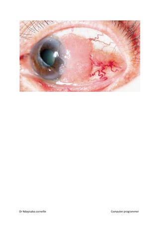 Dr Ndayisaba corneille Computer programmer
 