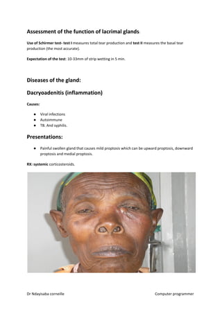Assessment of the function of lacrimal glands​​:
Use of Schirmer test- test I​​ measures total tear production and ​test II​​ measures the basal tear
production (the most accurate).
Expectation of the test​​: 10-33mm of strip wetting in 5 min.
Diseases of the gland:
Dacryoadenitis (inflammation)
Causes:
● Viral infections
● Autoimmune
● TB. And syphilis.
Presentations:
● Painful swollen gland that causes mild proptosis which can be upward proptosis, downward
proptosis and medial proptosis.
RX: systemic​​ corticosteroids.
Dr Ndayisaba corneille Computer programmer
 