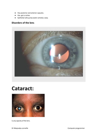 ● Has posterior and anterior capsules.
● Has got a cortex.
● Epithelial cells pump water actively a way.
Disorders of the lens​​:
Cataract:
Is any opacity of the lens.
Dr Ndayisaba corneille Computer programmer
 
