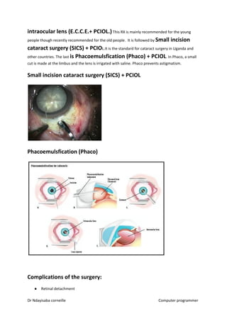 intraocular lens (E.C.C.E.+ PCIOL.)​​ This RX is mainly recommended for the young
people though recently recommended for the old people. It is followed by ​Small incision
cataract surgery (SICS) + PCIO​​L.It is the standard for cataract surgery in Uganda and
other countries. The last ​is Phacoemulsfication (Phaco) + PCIOL​​. In Phaco, a small
cut is made at the limbus and the lens is irrigated with saline. Phaco prevents astigmatism.
Small incision cataract surgery (SICS) + PCIOL
Phacoemulsfication (Phaco)
Complications of the surgery:
● Retinal detachment
Dr Ndayisaba corneille Computer programmer
 