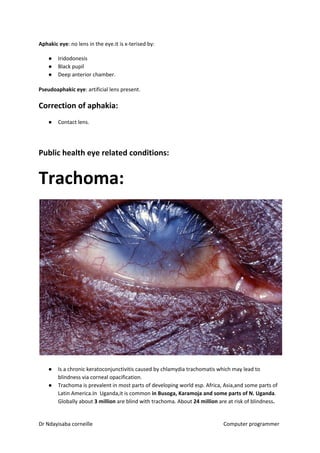 Aphakic eye​​: no lens in the eye.it is x-terised by:
● Iridodonesis
● Black pupil
● Deep anterior chamber.
Pseudoaphakic eye​​: artificial lens present.
Correction of aphakia:
● Contact lens.
Public health eye related conditions:
Trachoma:
● Is a chronic keratoconjunctivitis caused by chlamydia trachomatis which may lead to
blindness via corneal opacification.
● Trachoma is prevalent in most parts of developing world esp. Africa, Asia,and some parts of
Latin America.In Uganda,it is common ​in Busoga, Karamoja and some parts of N. Uganda​​.
Globally about ​3 million​​ are blind with trachoma. About ​24 million​​ are at risk of blindness​.
Dr Ndayisaba corneille Computer programmer
 