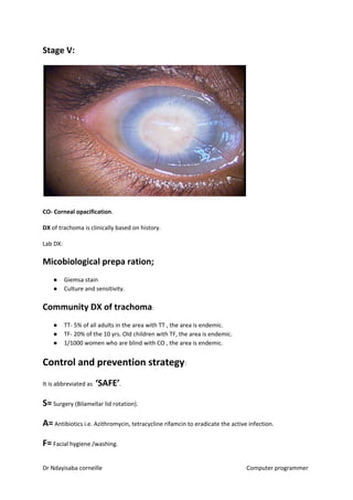 Stage V:
CO- Corneal opacification​​.
DX ​​of trachoma is clinically based on history.
Lab DX:
Micobiological prepa ration;
● Giemsa stain
● Culture and sensitivity.
Community DX of trachoma​​:
● TT- 5% of all adults in the area with TT , the area is endemic.
● TF- 20% of the 10 yrs. Old children with TF, the area is endemic.
● 1/1000 women who are blind with CO , the area is endemic.
Control and prevention strategy​​:
It is abbreviated as ​‘SAFE’​​.
S=​​ Surgery (Bilamellar lid rotation).
A=​​ Antibiotics i.e. Azithromycin, tetracycline rifamcin to eradicate the active infection.
F=​​ Facial hygiene /washing.
Dr Ndayisaba corneille Computer programmer
 