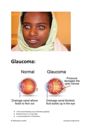 Glaucoma:
● Is the second leading cause of blindness globally.
● Blindness from it is irreversible
● Is a preventable form of blindness.
Dr Ndayisaba corneille Computer programmer
 