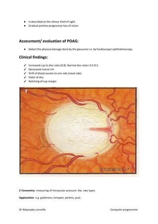 ● Is described as the silence thief of sight.
● Gradual painless progressive loss of vision.
Assessment/ evaluation of POAG:
● Detect the physical damage done by the glaucoma i.e. by fundoscopy/ ophthalmoscopy
Clinical findings:
✓ Increased cup to disc ratio (0.8). Normal disc ratio= 0.2-0.5.
✓ Decreased nueral rim
✓ Shift of blood vessels to one side (nasal side)
✓ Pallor of disc
✓ Notching of cup margin
2 Tonometry​​- measuring of intraocular pressure. Has two types
Applanation​​ e.g. goldmann, tonopen, perkins, pust.
Dr Ndayisaba corneille Computer programmer
 