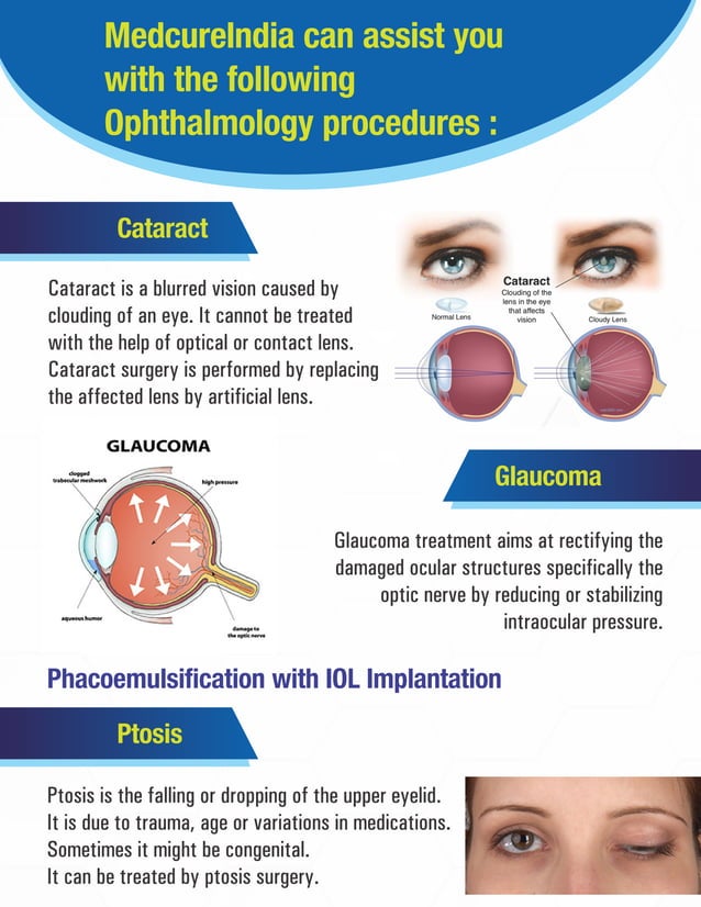 Ophthalmology Procedures List Ophthalmic Surgical Procedures Pdf