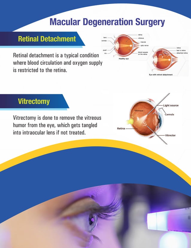 Ophthalmology Procedures List Ophthalmic Surgical Procedures Pdf
