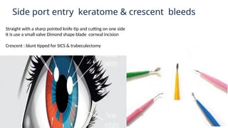 Comprehensive Overview of Ophthalmology Instruments: Types, Uses, and ...