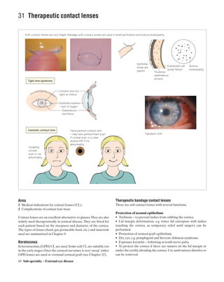 Ophthalmology at a Glance.pdf