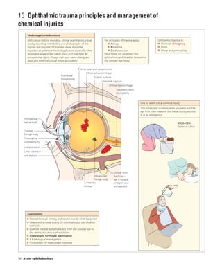 Ophthalmology At A Glance pdf Ophthalmology At A Glance pdf