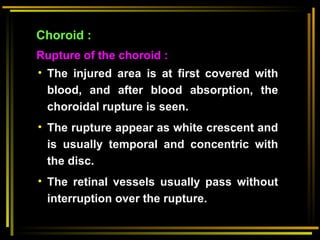 Choiroidal Rupture Ophthalmologyblunt ocular truma lecture.ppt