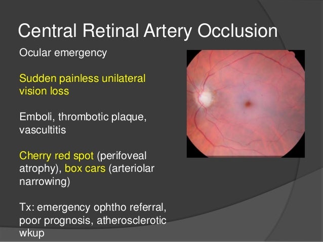 Ophthalmology Board Review- Emergency Medicine 2014