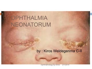 1

OPHTHALMIA
NEONATORUM

by : Kiros Weldegerima C-II

Ophthalmology by Kiros

2/1/2014

 