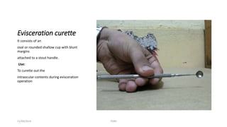 Evisceration curette 
It consists of an 
oval or rounded shallow cup with blunt 
margins 
attached to a stout handle. 
Use: 
To curette out the 
intraocular contents during evisceration 
operation 
11/09/2014 TONY 
 