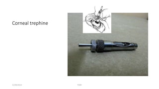 Corneal trephine 
11/09/2014 TONY 
 