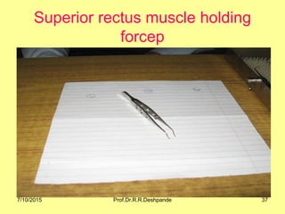 Superior rectus muscle holding
forcep
7/10/2015 37Prof.Dr.R.R.Deshpande
 