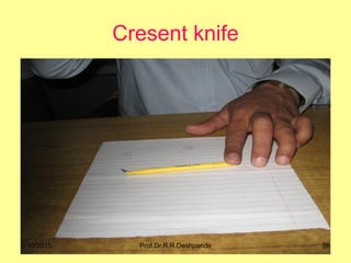 Cresent knife
7/10/2015 56Prof.Dr.R.R.Deshpande
 
