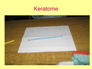 Keratome
7/10/2015 58Prof.Dr.R.R.Deshpande
 