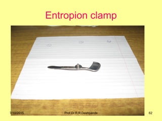 Entropion clamp
7/10/2015 62Prof.Dr.R.R.Deshpande
 