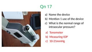 Qn 17
a) Name the device
b) Mention 1 use of the device
c) What is the normal range of
intraocular pressure?
a) Tonometer
b) Measuring IOP
c) 10-21mmHg
 