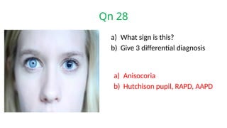 Qn 28
a) What sign is this?
b) Give 3 differential diagnosis
a) Anisocoria
b) Hutchison pupil, RAPD, AAPD
 