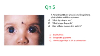 Qn 5
A 7 months old baby presented with epiphora,
photophobia and blepharospasm.
a) What sign do you see?
b) What is your diagnosis?
c) How will you manage this patient?
a) Bupthalmos
b) Congenital glaucoma
c) Timolol eye drops 0.5% 1-2 times/day
 