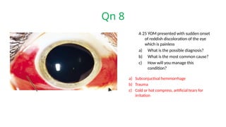 Qn 8
A 25 YOM presented with sudden onset
of reddish discoloration of the eye
which is painless
a) What is the possible diagnosis?
b) What is the most common cause?
c) How will you manage this
condition?
a) Subconjuctival hemmorrhage
b) Trauma
c) Cold or hot compress, artificial tears for
irritation
 