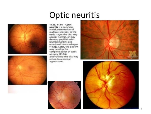 Ophthalmology ospe cc