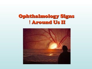 Ophthalmology SignsOphthalmology Signs
Around Us IIAround Us II!!
By
Dr.Ahmed Alsherbiny
MSc. Ophth
 