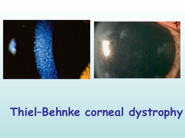 ophthalmology signs around us ii 14 638