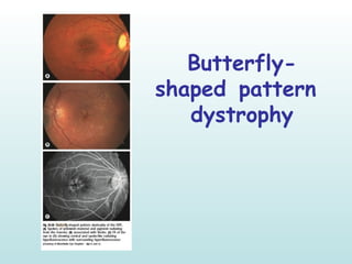 Ophthalmology Signs Around Us III ! | PPT