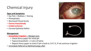 Decreases Visual Sign Ophthalmology lecture.pptx