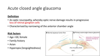 Acute closed angle glaucoma
Definition
• An optic neuropathy, whereby optic nerve damage results in progressive
loss of retinal ganglion cells
• Characterised by narrowing of the anterior chamber angle
Risk factors
• Age >50, female
• Family history
• Asian
• Hyperopia (longsightedness)
 