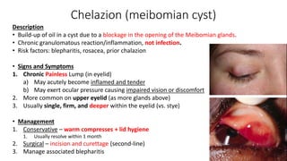 Chelazion (meibomian cyst)
Description
• Build-up of oil in a cyst due to a blockage in the opening of the Meibomian glands.
• Chronic granulomatous reaction/inflammation, not infection.
• Risk factors: blepharitis, rosacea, prior chalazion
• Signs and Symptoms
1. Chronic Painless Lump (in eyelid)
a) May acutely become inflamed and tender
b) May exert ocular pressure causing impaired vision or discomfort
2. More common on upper eyelid (as more glands above)
3. Usually single, firm, and deeper within the eyelid (vs. stye)
• Management
1. Conservative – warm compresses + lid hygiene
1. Usually resolve within 1 month
2. Surgical – incision and curettage (second-line)
3. Manage associated blepharitis
 