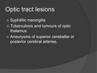 Optic tract lesions
 Syphilitic meningitis
 Tuberculosis and tumours of optic
thalamus
 Aneurysms of superior cerebellar or
posterior cerebral arteries.
 