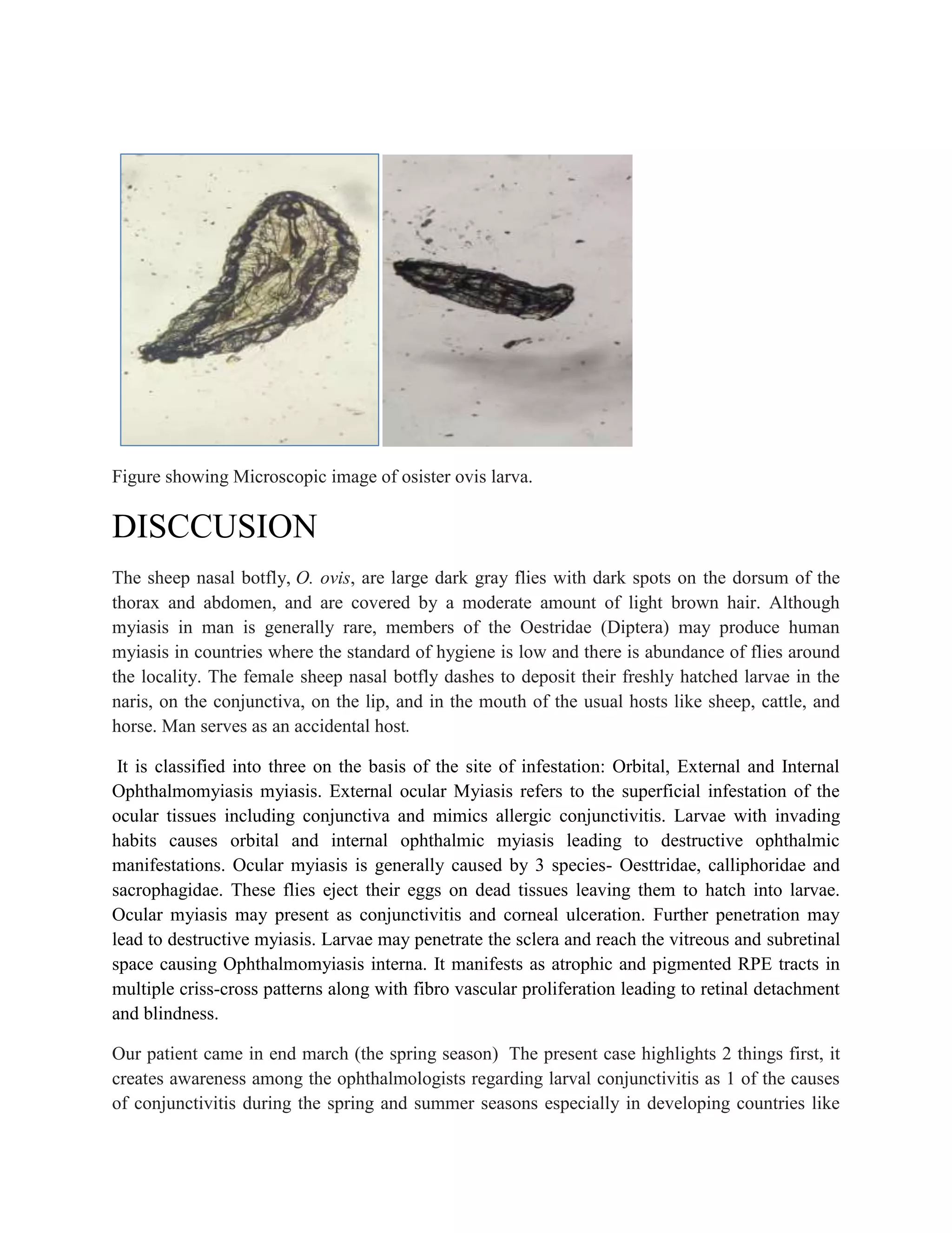 Figure showing Microscopic image of osister ovis larva.
DISCCUSION
The sheep nasal botfly, O. ovis, are large dark gray flies with dark spots on the dorsum of the
thorax and abdomen, and are covered by a moderate amount of light brown hair. Although
myiasis in man is generally rare, members of the Oestridae (Diptera) may produce human
myiasis in countries where the standard of hygiene is low and there is abundance of flies around
the locality. The female sheep nasal botfly dashes to deposit their freshly hatched larvae in the
naris, on the conjunctiva, on the lip, and in the mouth of the usual hosts like sheep, cattle, and
horse. Man serves as an accidental host.
It is classified into three on the basis of the site of infestation: Orbital, External and Internal
Ophthalmomyiasis myiasis. External ocular Myiasis refers to the superficial infestation of the
ocular tissues including conjunctiva and mimics allergic conjunctivitis. Larvae with invading
habits causes orbital and internal ophthalmic myiasis leading to destructive ophthalmic
manifestations. Ocular myiasis is generally caused by 3 species- Oesttridae, calliphoridae and
sacrophagidae. These flies eject their eggs on dead tissues leaving them to hatch into larvae.
Ocular myiasis may present as conjunctivitis and corneal ulceration. Further penetration may
lead to destructive myiasis. Larvae may penetrate the sclera and reach the vitreous and subretinal
space causing Ophthalmomyiasis interna. It manifests as atrophic and pigmented RPE tracts in
multiple criss-cross patterns along with fibro vascular proliferation leading to retinal detachment
and blindness.
Our patient came in end march (the spring season) The present case highlights 2 things first, it
creates awareness among the ophthalmologists regarding larval conjunctivitis as 1 of the causes
of conjunctivitis during the spring and summer seasons especially in developing countries like
 