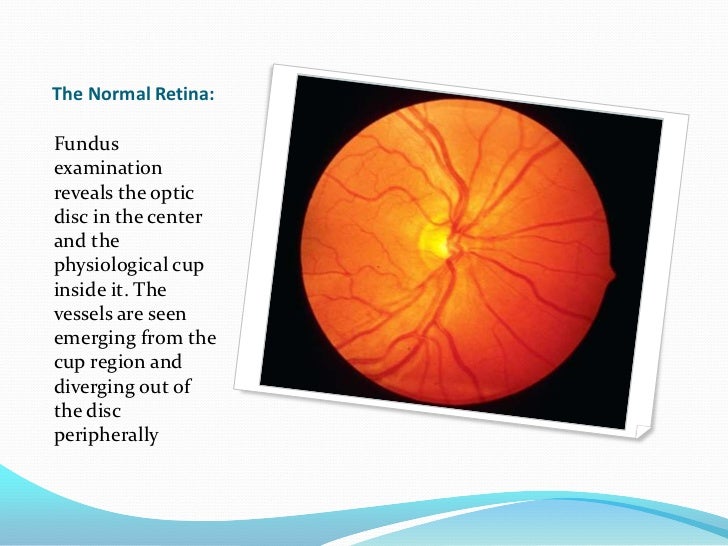 Ophthalmoscopic examination