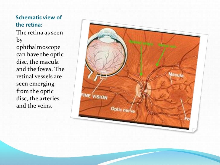 Ophthalmoscopic examination