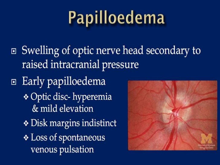 Ophthalmoscopic examination