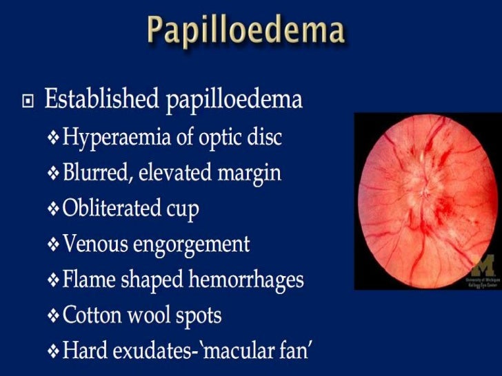 Ophthalmoscopic examination