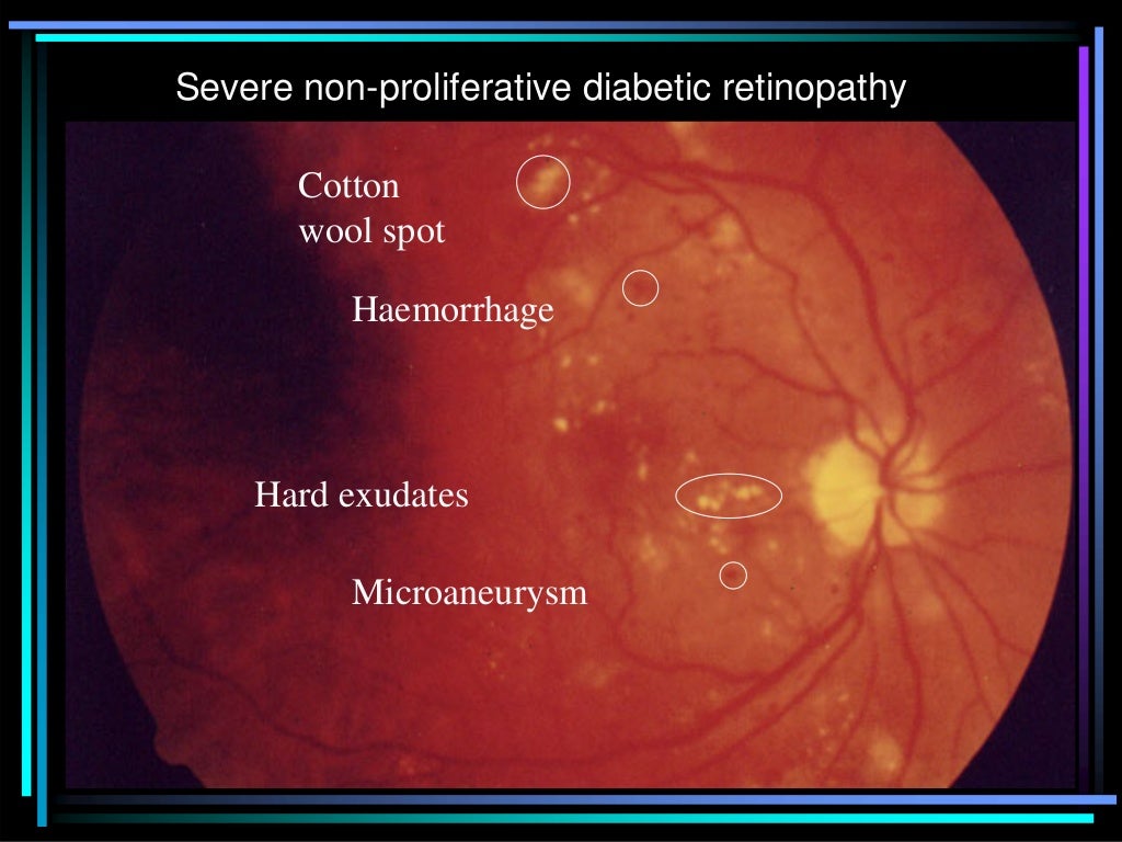 Ophthalmoscopic slides