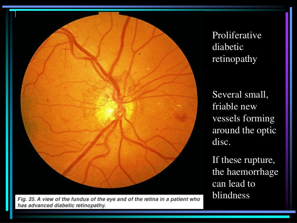 Ophthalmoscopic slides