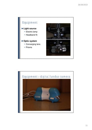 26/04/2010




Equipment
►Light source
   Electric lamp
   Headband fit


►Optic system
   Converging lens
   Prisms




Equipment : digital fundus camera




                                           11
 