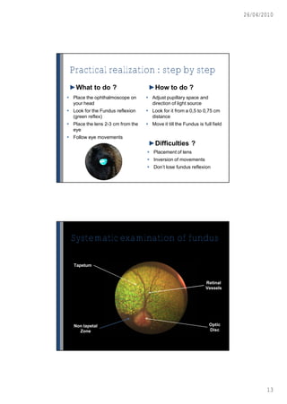 26/04/2010




 Practical realization : step by step
 ►What to do ?                      ►How to do ?
 Place the ophthalmoscope on       Adjust pupillary space and
  your head                          direction of light source
 Look for the Fundus reflexion     Look for it from a 0,5 to 0,75 cm
  (green reflex)                     distance
 Place the lens 2-3 cm from the    Move it till the Fundus is full field
  eye
 Follow eye movements
                                    ►Difficulties ?
                                    Placement of lens
                                    Inversion of movements
                                    Don’t lose fundus reflexion




 Systematic examination of fundus

   Tapetum


                                                                 Retinal
                                                                 Vessels




   Non tapetal                                                     Optic
     Zone                                                          Disc




                                                                                    13
 