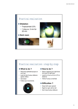 26/04/2010




Practical realization
►Dilatation
   Tropicamide 0,5%
   1 drop ev. 5 min for
    20 min

►Dark room




Practical realization : step by step
►What to do ?                     ►How to do ?
 Place the ophthalmoscope on      Place it against your right brow
  your eye                          (for exam of right eye)
 Look for the Fundus reflexion    Look for it from a 0,5 to 0,75 m
  (green reflex)                    distance
 Get closer                       Till the Fundus is full field
 Follow eye movements
                                  ►Difficulties ?
                                   Keep both eyes opened
                                   Right for right, left for left
                                   Don’t lose fundus reflexion




                                                                               6
 