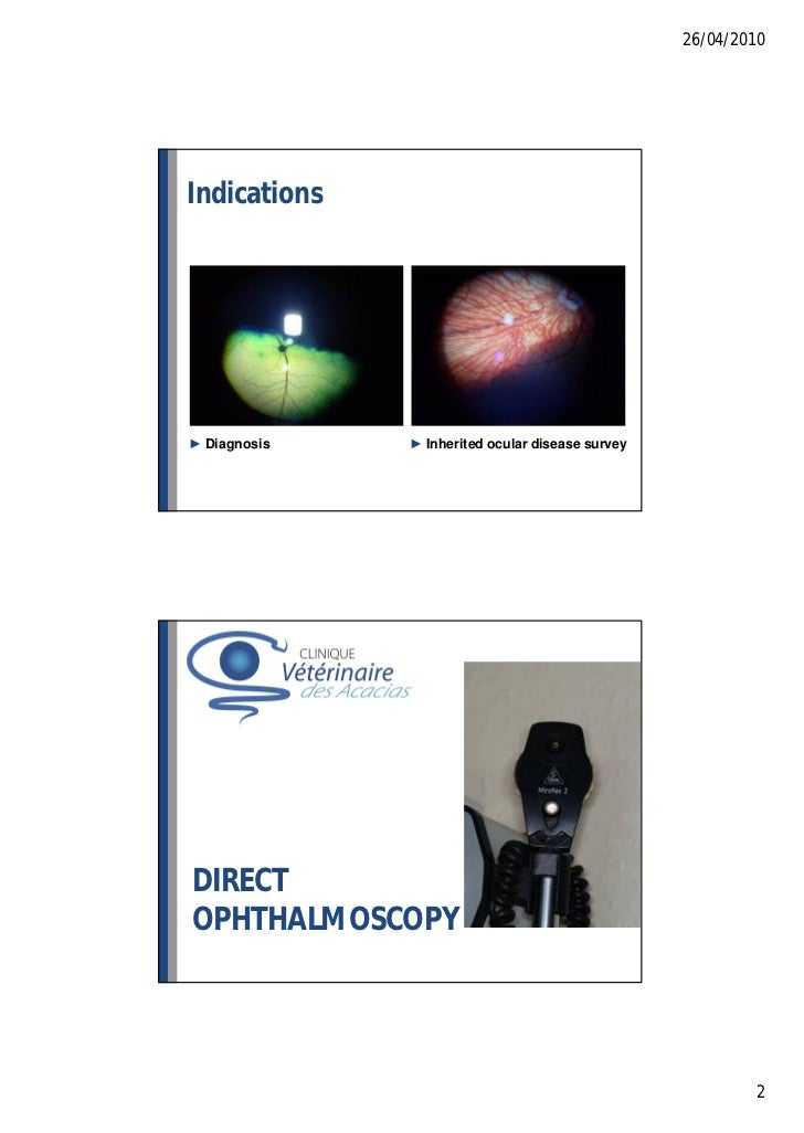 Ophthalmoscopy