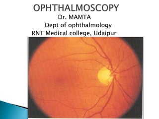 Dr. MAMTA
Dept of ophthalmology
RNT Medical college, Udaipur
 