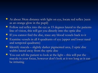  At about 30cm distance with light on eye, locate red reflex (seen
At about 30cm distance with light on eye, locate red reflex (seen
as an orange glow in the pupil)
as an orange glow in the pupil)
 Follow red reflex into the eye as 15 degrees lateral to the patients
Follow red reflex into the eye as 15 degrees lateral to the patients
line of vision, this will get you directly into the optic disc
line of vision, this will get you directly into the optic disc
 If you cannot find the disc, trace any blood vessels back to it
If you cannot find the disc, trace any blood vessels back to it
 Examine vessels in all 4 quadrants of eye (upper and lower nasal
Examine vessels in all 4 quadrants of eye (upper and lower nasal
and temporal quadrants)
and temporal quadrants)
 Identify macula – slightly darker pigmented area, 2 optic disc
Identify macula – slightly darker pigmented area, 2 optic disc
widths lateral away from the optic disc
widths lateral away from the optic disc
 You can tell the patient to look at the light – this will put the
You can tell the patient to look at the light – this will put the
macula in your focus, however don’t look at it too long as it can
macula in your focus, however don’t look at it too long as it can
be irritating
be irritating
 