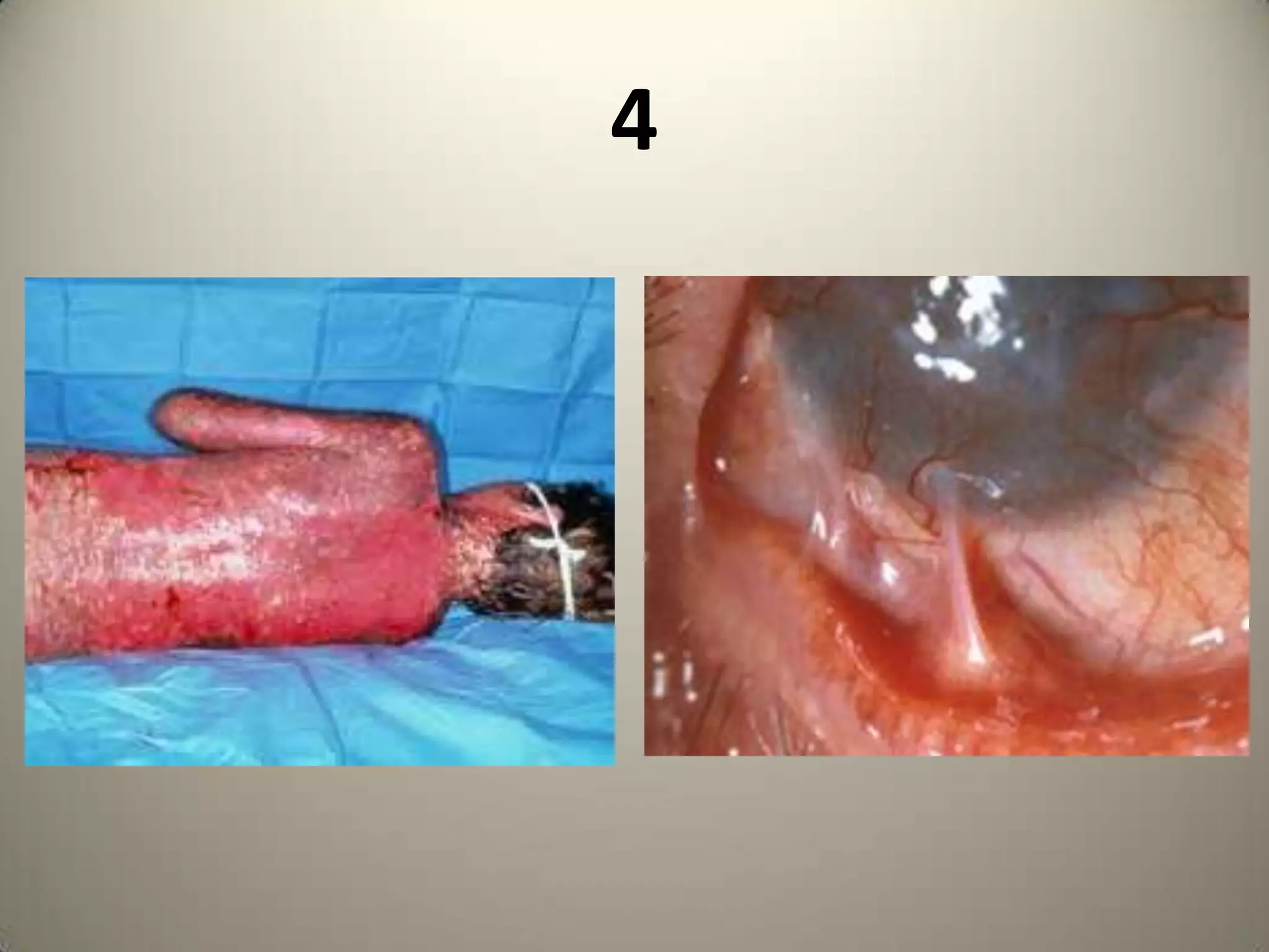 George CoatsBetween 5-10 yrs  in boys